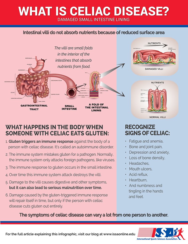 Celiac Disease explained